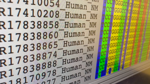 gene sequence results - shigella 