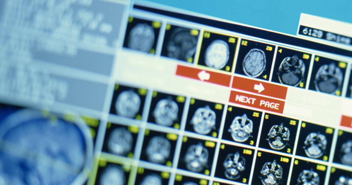 Résidents de la maison: comment les programmes de résidence de l’UNM tiennent les professionnels de la santé dans l’État