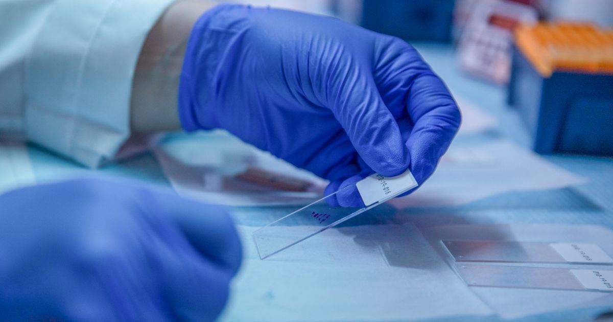 UNM Scientist Studies Where Brain Cancer Cells Hide and How To Fight Them