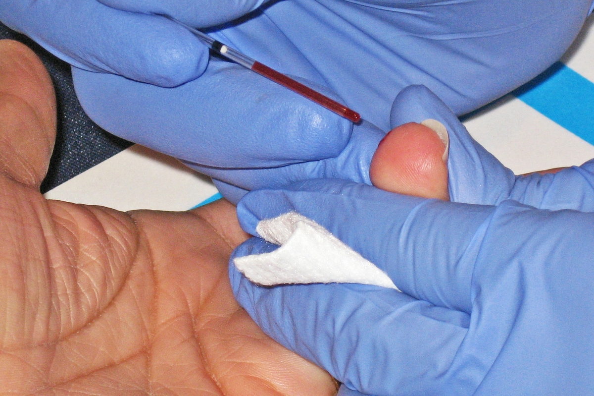  Blood draw from finger stick