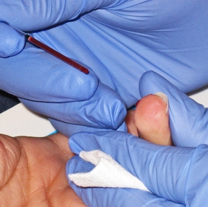 Blood draw for testing