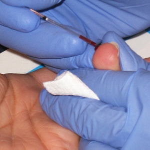 Finger stick-blood test