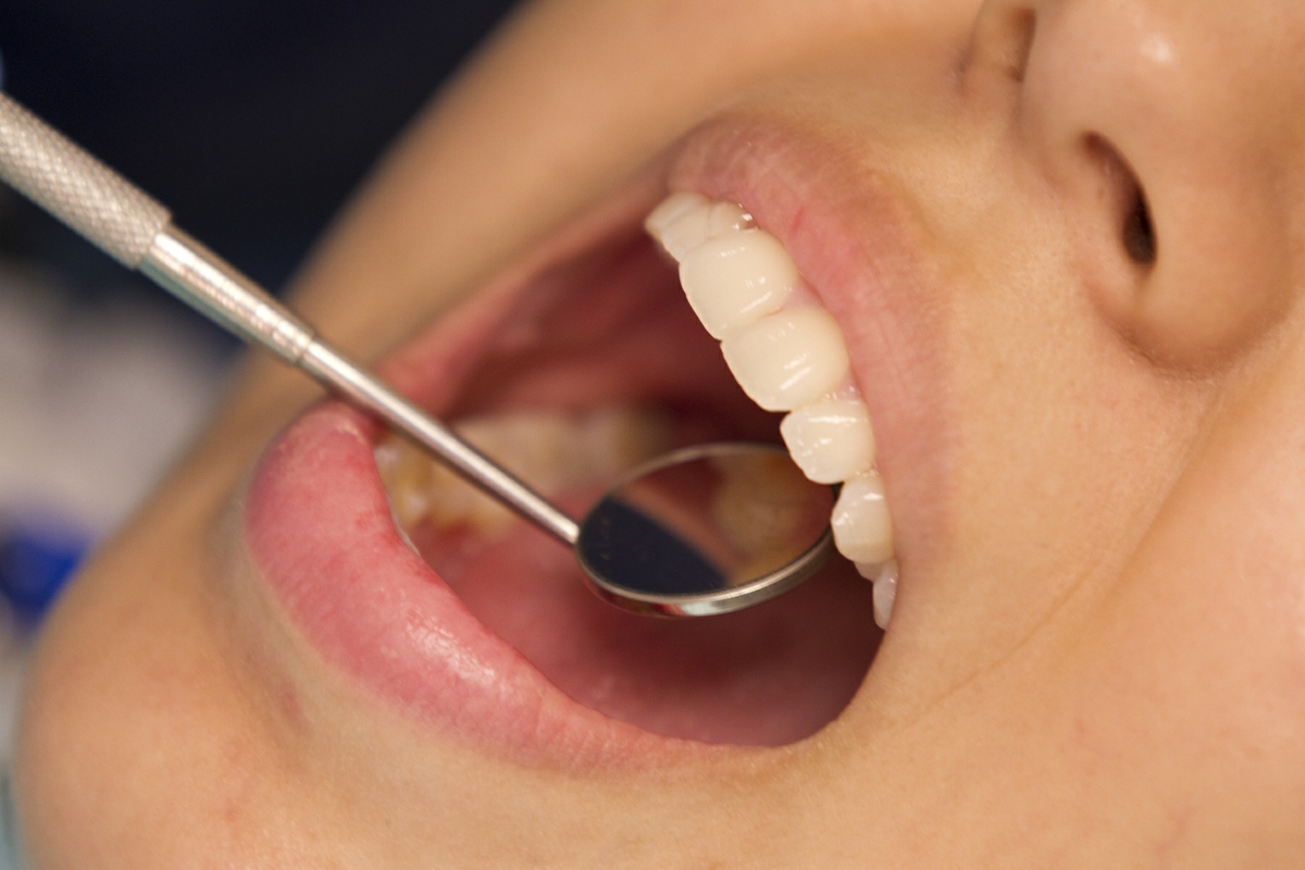 Dental exam Horizontal