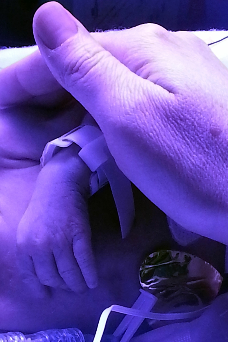 Premature baby