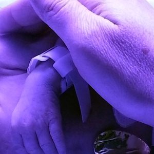 Premature baby