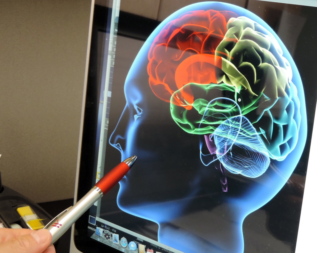 Doctor reviewing brain image up close