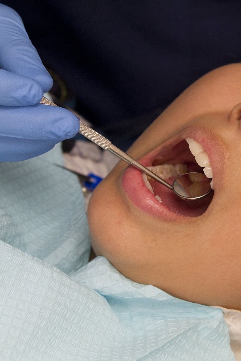 dental exam - woman