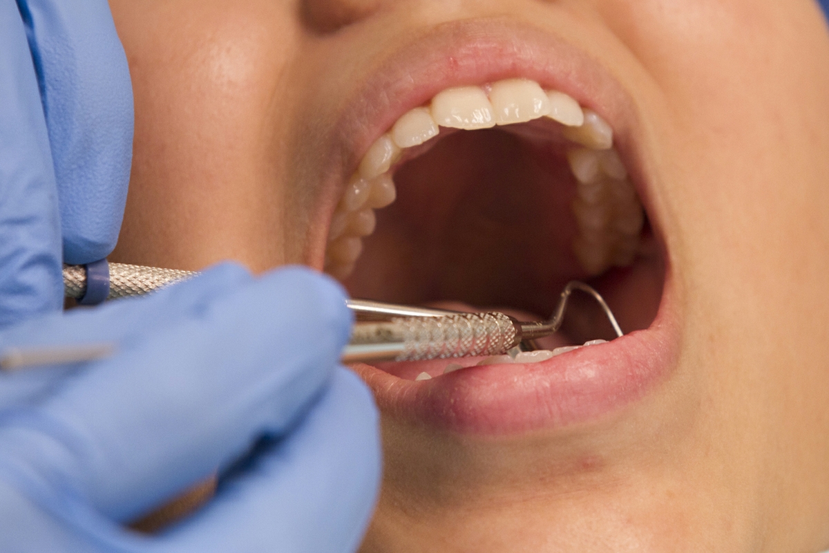 Dental exam - woman's mouth