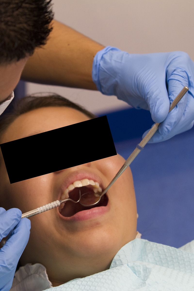 Dental exam (V)