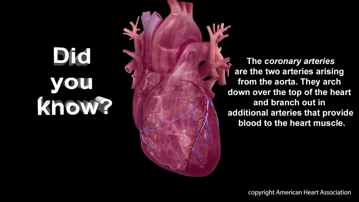 Coronary Artery Infographic