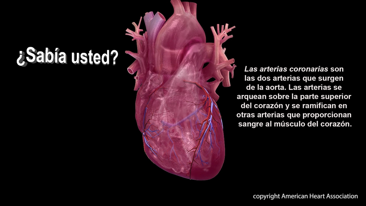 Coronary Artery- Spanish