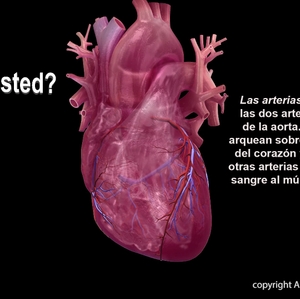 Coronary Artery- Spanish