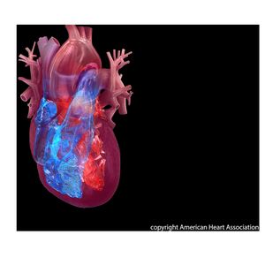 New research finds 62% of AFib patients were unaware of the condition before diagnosis