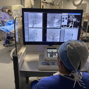 Surgeons successfully treat brain aneurysms using a robot