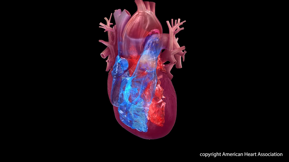 Avoid a Holiday Heart Attack or Stroke ANR