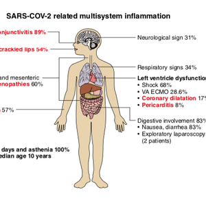 Schematic of Symptoms
