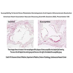 Infographic Abstract 126-Kireccibasi