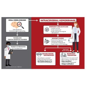 New guideline refines care for brain bleeds: compression socks, some meds not effective 