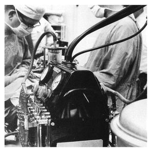 First Mechanical Heart - 1950's