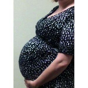 Most people giving birth in the U.S. have poor heart health prior to pregnancy
