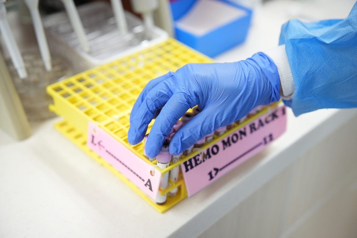 Blood vials processed in lab
