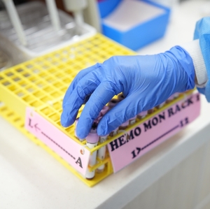 Blood vials processed in lab
