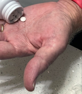 Long-term use of melatonin supplements to support sleep may have negative health effects 