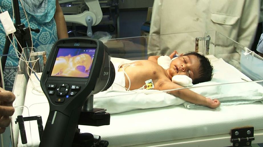 Xerox-Manipal-University-Hospital-Neonatologie_2